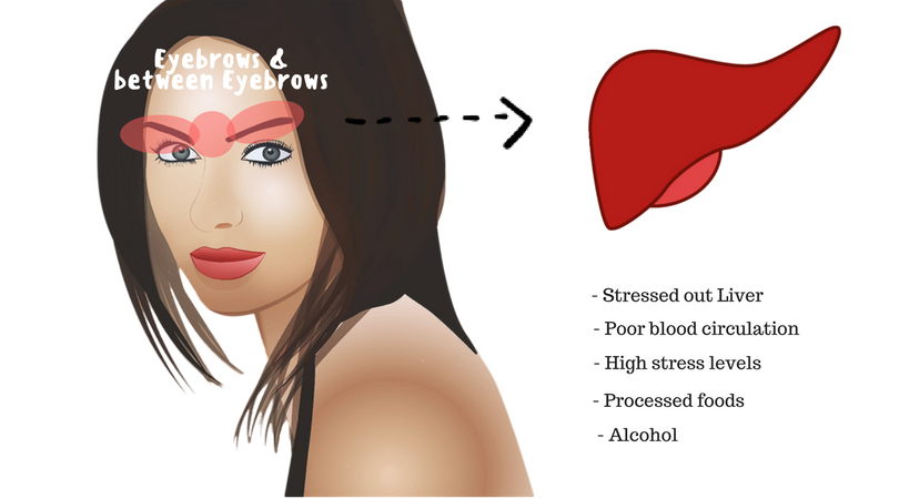 Acne Face Chart Meaning