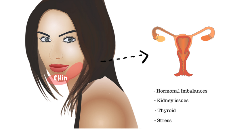 chinese face mapping acne