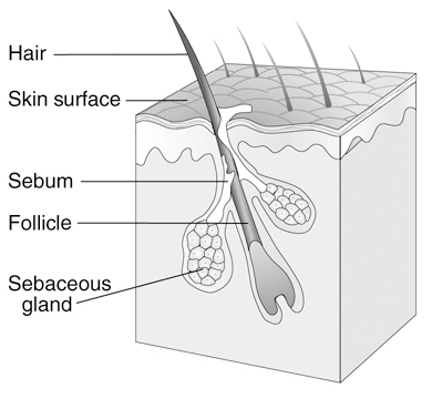 chinese face mapping acne