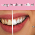 teeth whitening solutions