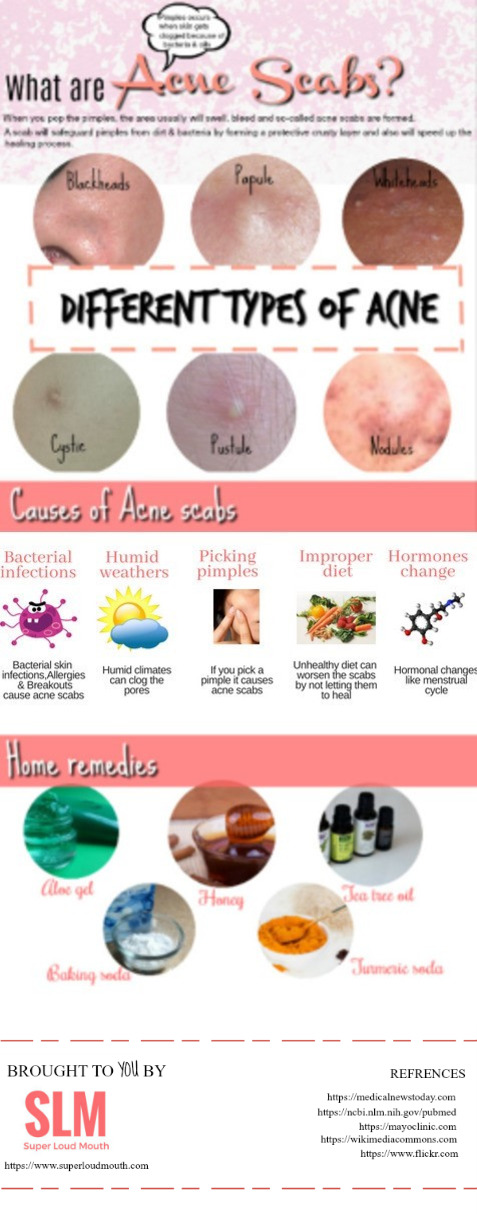 how to get rid of acne scabs