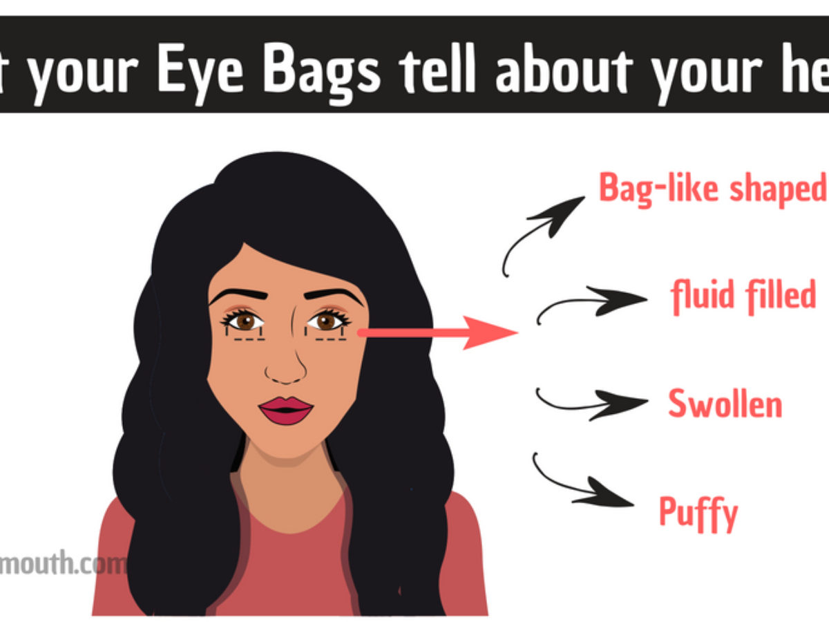 Genelde oluşturmak daimi bags under eyes kidney Hazır oldu Rulman