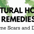 natural home remedies to heal acne scars and dark spots