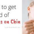 how to get rid of pimples on chin (1)