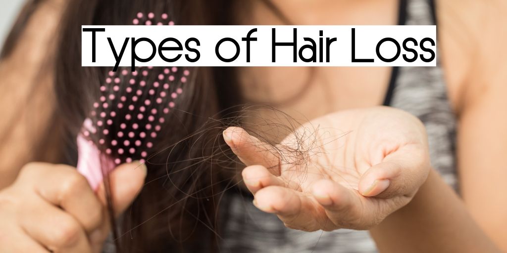 types of hair loss