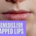 home remedies for chapped lips