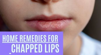 10 Natural Home Remedies for Chapped Lips