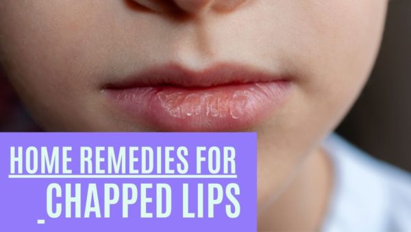 home remedies for chapped lips